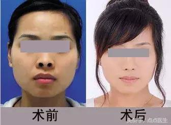 整容四大危险手术,整容的七大骗局