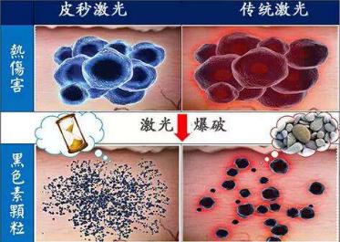 范冰冰推荐祛斑,范冰冰推荐美白淡斑面膜