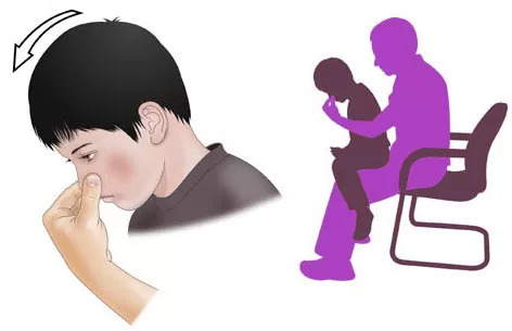 孩子流鼻血该怎么止血？怎么处理？