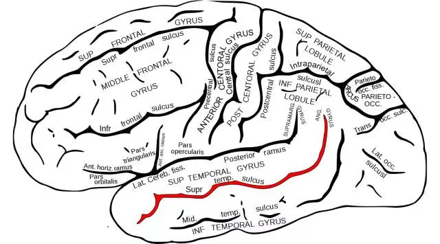 不识妻子脸盲症是什么,轻度脸盲症能分清美丑