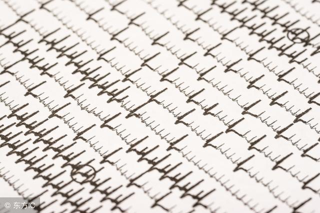 房颤的最佳治疗原则,房颤的治疗原则是什么