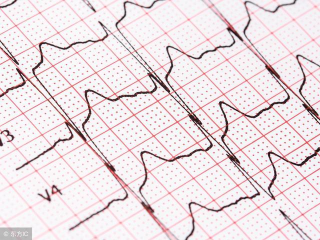 房颤的最佳治疗原则,房颤的治疗原则是什么