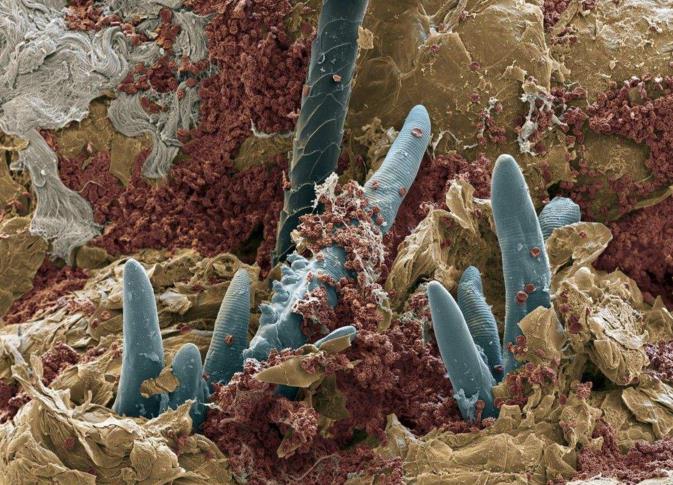 家中螨虫怎么消灭,家里全是螨虫教你一招除螨