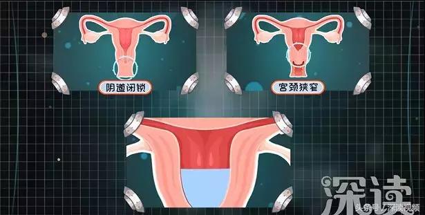 痛经，不孕竟是自己作出来的病，最萌“大姨妈”首秀，笑出猪叫声