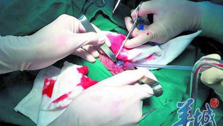 儿子睾丸疼附睾炎是怎么引起的,少年左侧睾丸隐隐作痛可以自愈吗