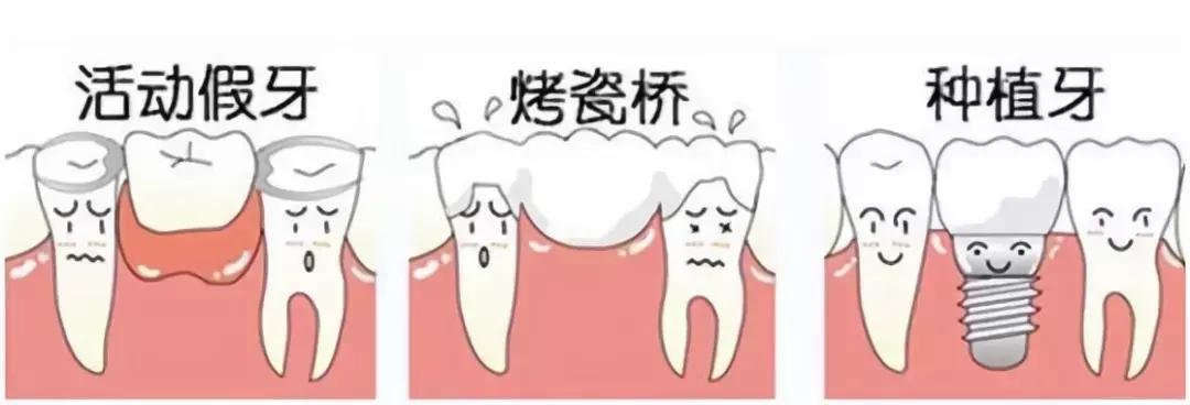 下牙缺失导致舌头变大,口腔牙列缺失患者情况