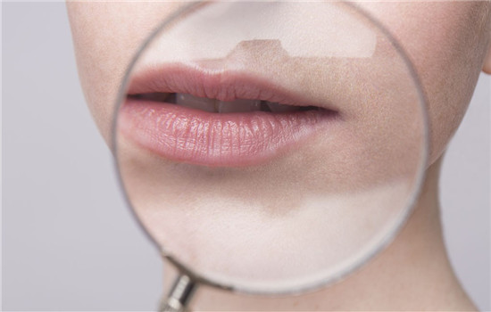 怎么改善唇纹唇部护理,淡化唇纹唇部去黑护理