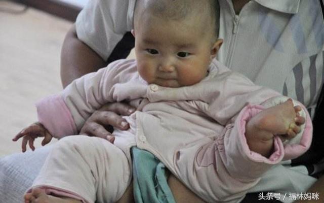 宝宝拉肚子有什么快速解决办法,宝宝拉肚子的原因有哪些