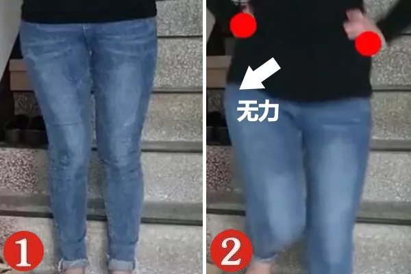 走路扭臀是什么原因,走路扭臀什么原因