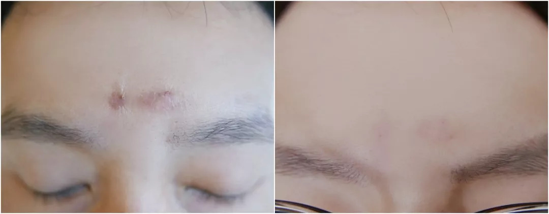 法国“奇愈”｜只需一晚就能治愈痘印的地方，你想去吗？