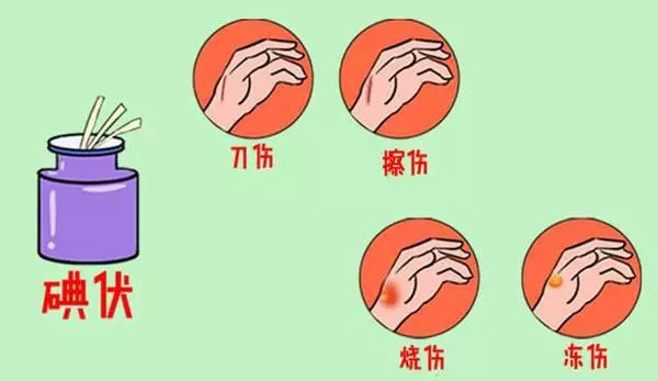 紫药水擦过的伤口,紫药水涂伤口注意事项