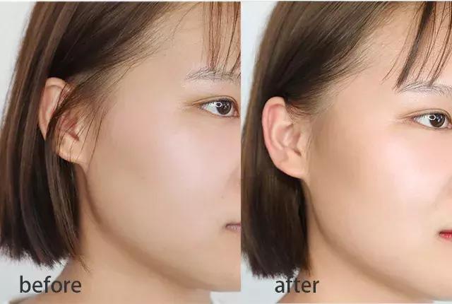 堪比整容的祛纹技巧,心机显瘦修容方法