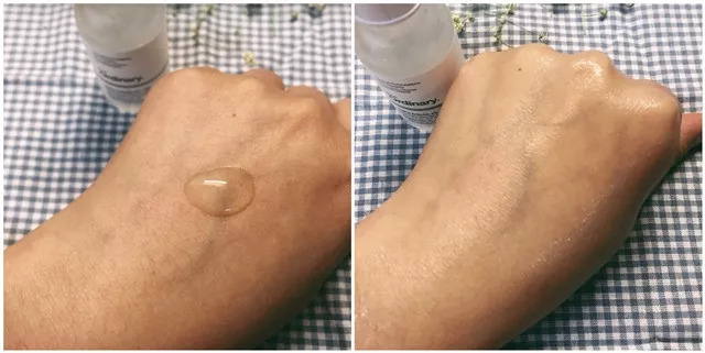 烂脸了啥也不敢用,烂脸还有得救吗