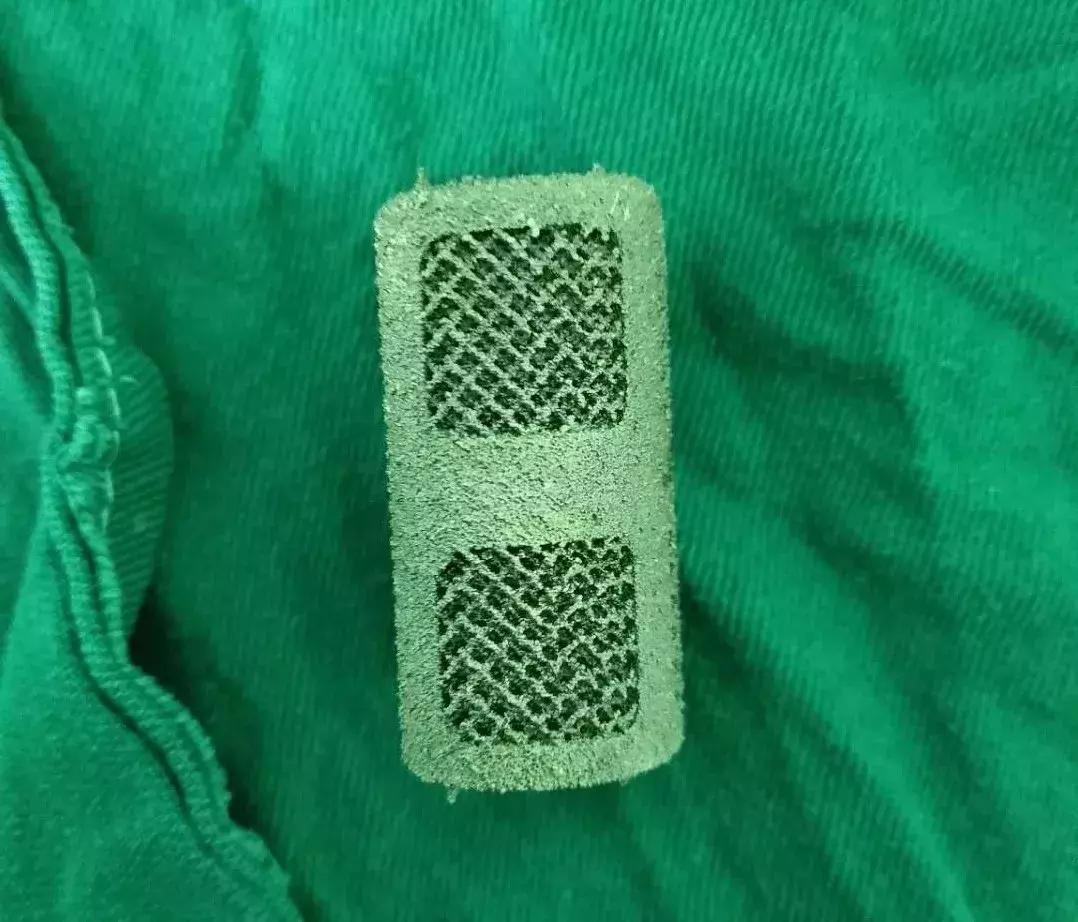 高位截瘫3d打印疗法,高位截瘫奇迹恢复