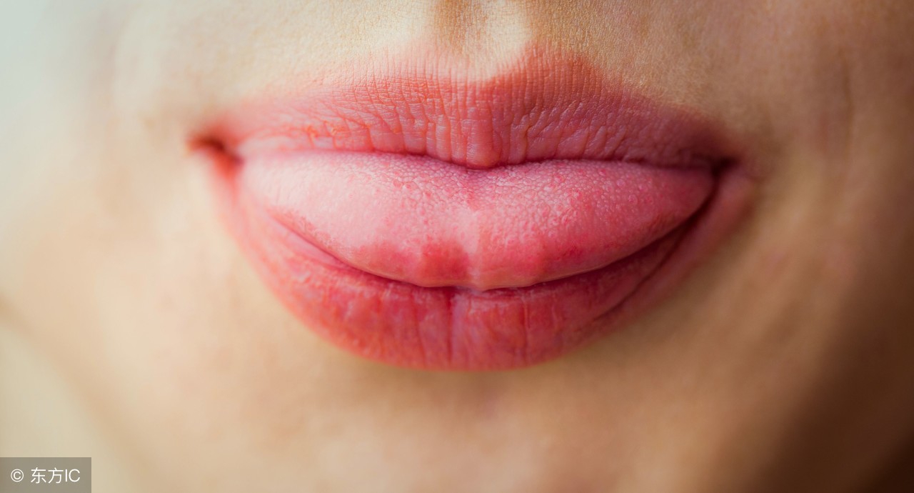 舌头上出现斑,舌头上有斑点是癌症前兆