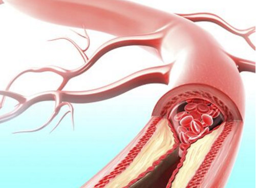 刚刚出生婴儿脸上长了肉痣怎么办,8个月宝宝脸上长雀斑样痣