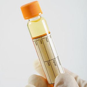 糖尿病酮症的酮体阳性指哪项,尿酮体和酮症酸中毒一样吗