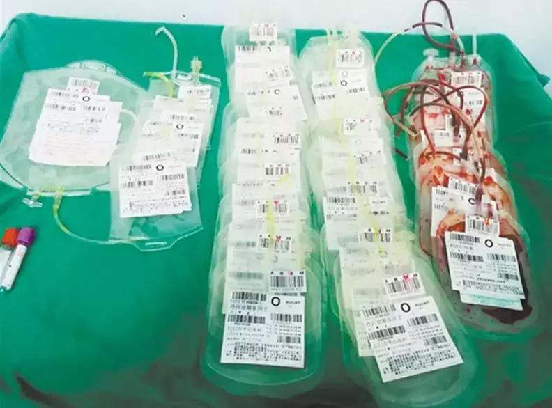 二胎妈妈怀孕三个月大出血,产妇引产大出血死亡