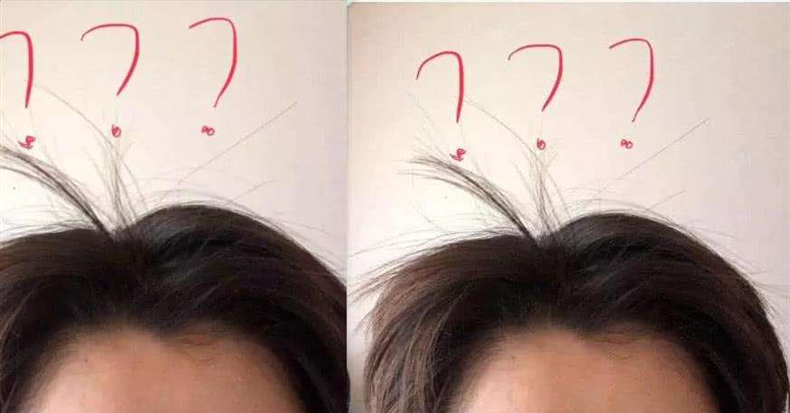 碎发多炸毛没有碎发神器,碎发整理神器戴法