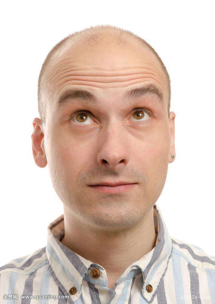 秃顶找上门中医建议不妨试试3招,秃顶中医怎么治疗最好