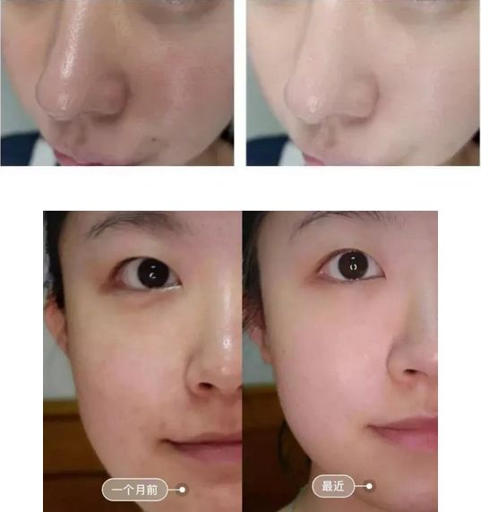 新西兰本土面霜怎么样,新西兰兰侬绵羊油面霜