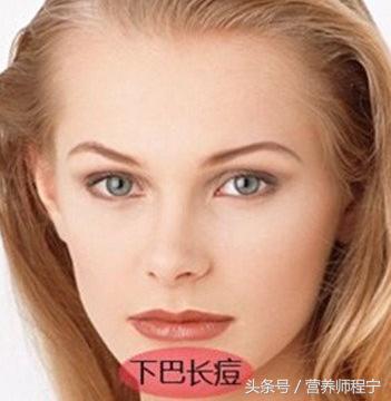 下巴不停冒脓包型痘痘药膏,下巴下面有痘痘冒白头