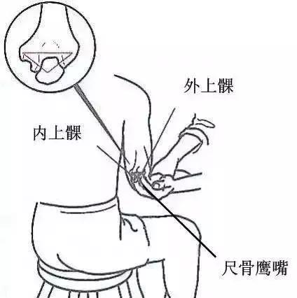 胳膊肘关节疼痛伸不直怎么办,胳膊肘内部疼痛伸不直什么原因