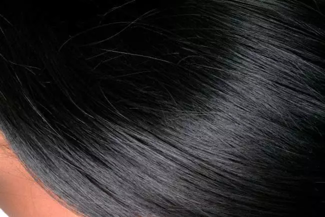 去腐国读书，脑壳秃了怎么补救？