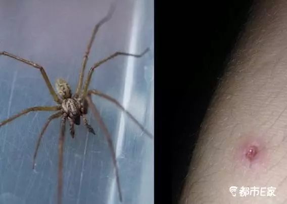 被马蜂蛰了怎么救治,男子被马蜂蜇伤146处伤