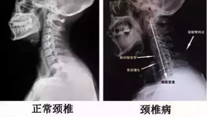颈椎腰腿疼神器,颈椎很难受有没有推荐的神器