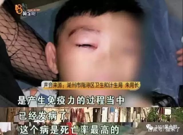 致死率100%的狂犬病有多厉害,致死率100%的狂犬病你该怎么预防