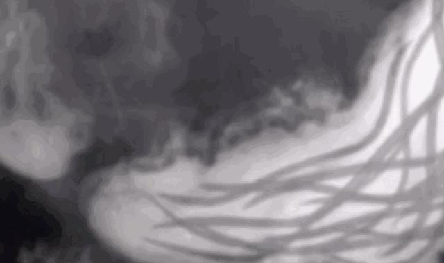 吃活物有寄生虫,吃活的虫子身体里有寄生虫