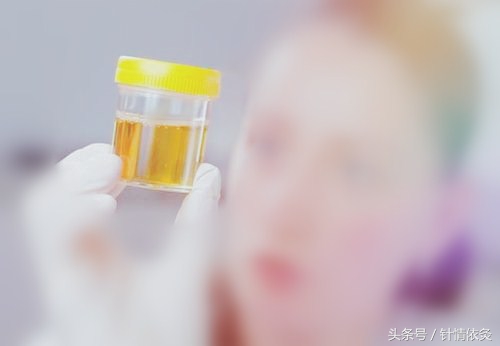 针灸治顽固咳喘,针灸治疗漏尿取穴