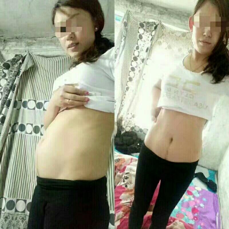 孕晚期五大症状证明胎儿发育正常,宝宝入盆大概什么时候卸货