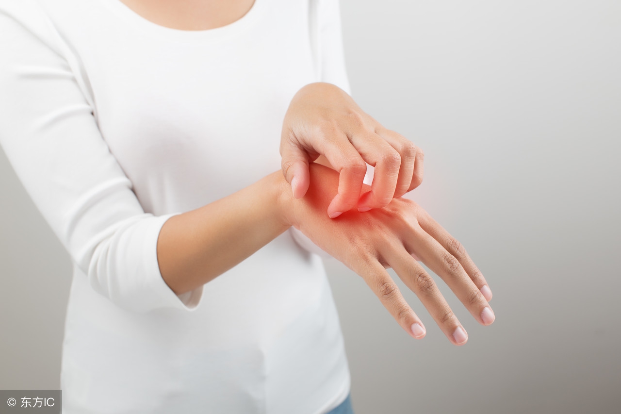 头皮脂溢性皮炎的10种症状图片,患有脂溢性皮炎怎么办