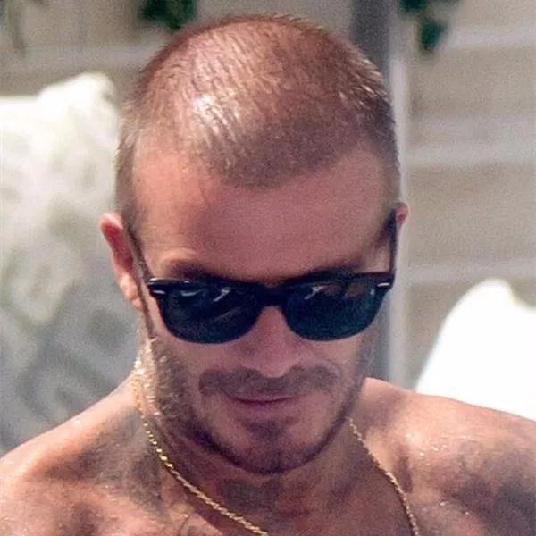 贝克汉姆被曝脱发角度问题,贝克汉姆面临谢顶危机