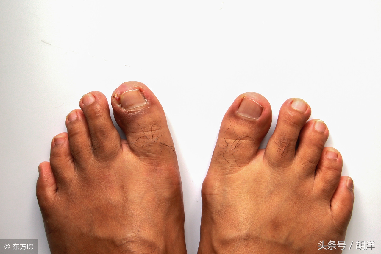 癌症特效靶向药有哪些副反应,发生副反应后如何处理,怎么避免