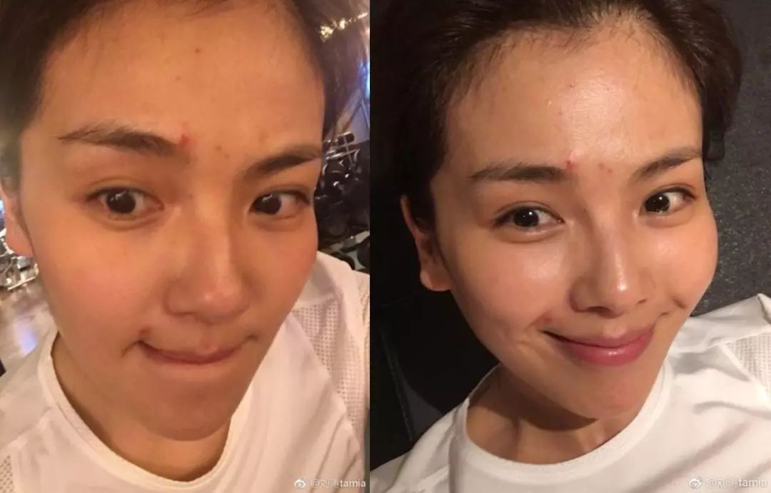 假期晒黑补救,假期出行晒黑皮