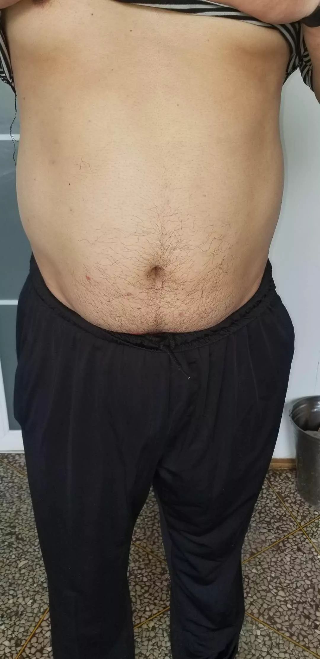 娴欐睙鐪佷腑鍖绘不鐤楅摱灞戠梾,鍏勫紵淇╅兘寰楃櫧鐧滈