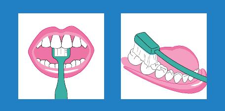 牙齿断了一半还变黑了怎么补,牙齿断了不补牙会怎么样
