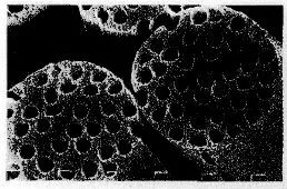 海岛纤维,海岛纤维和橘瓣纤维区别