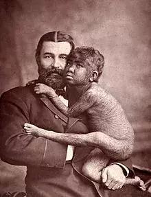 人类在演化中为什么会褪去体毛,人类的体毛怎么进化没了