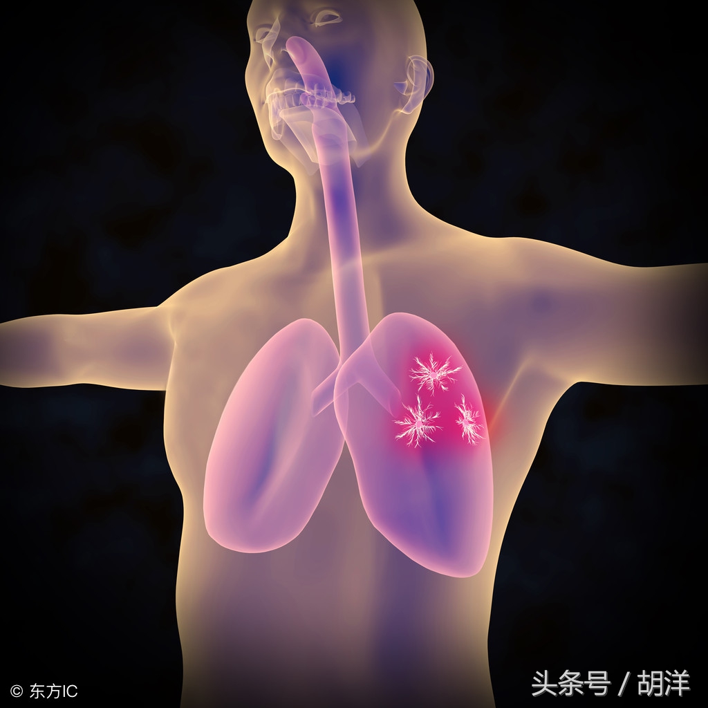 肿瘤标志物铁蛋白什么意思,肿瘤标志物中铁蛋白高说明什么