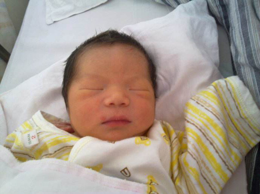 40天宝宝黄疸11点多有什么症状,新生儿abo溶血性黄疸症状及表现