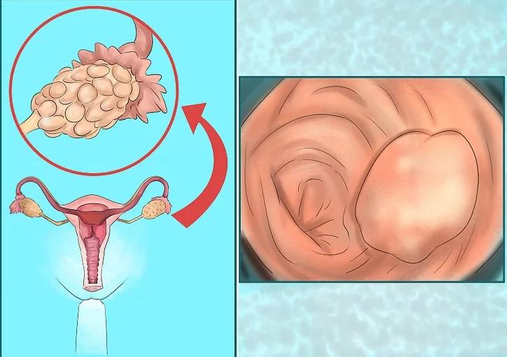 一次月经过多,一次月经少需要重视么