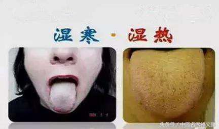 老中医告诉你湿气怎么回事,中医讲寒湿西医讲什么