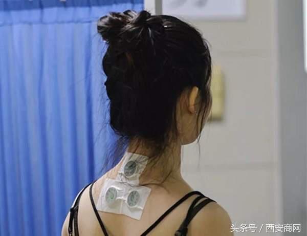 敷贴调治过敏性鼻炎，急不得！