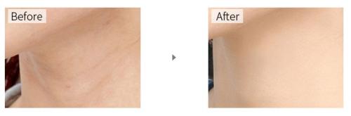 美容体验日本,专享美容美体