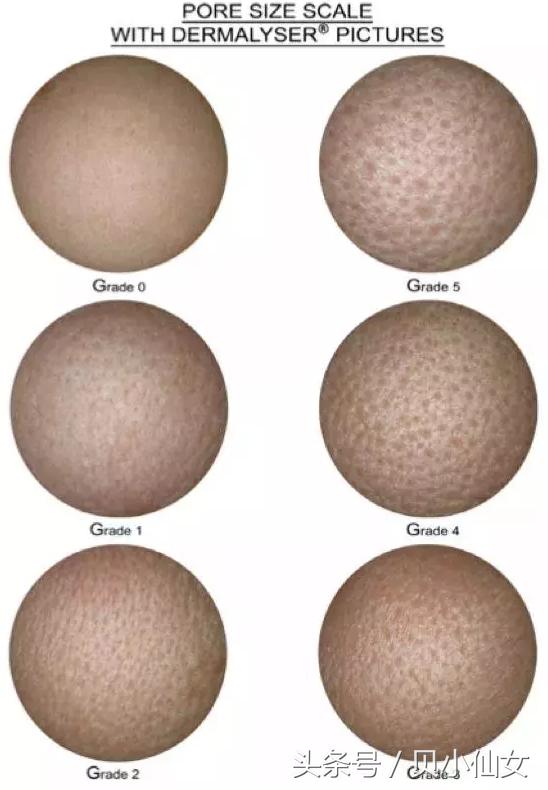 怎么才能让毛孔消失呢,怎么拯救我的毛孔