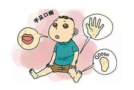 小孩刚得轻微手足口病怎么办,小孩得了手足口病如何处理